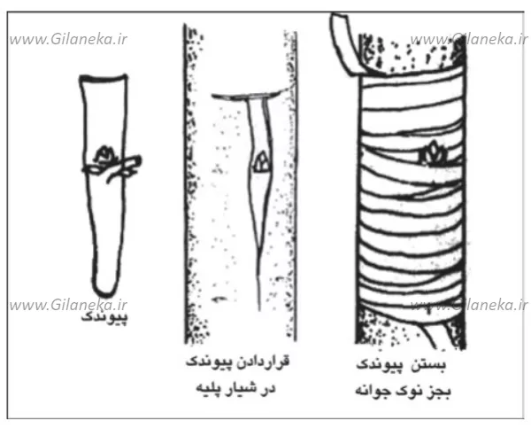 پيوند سپري شكمي